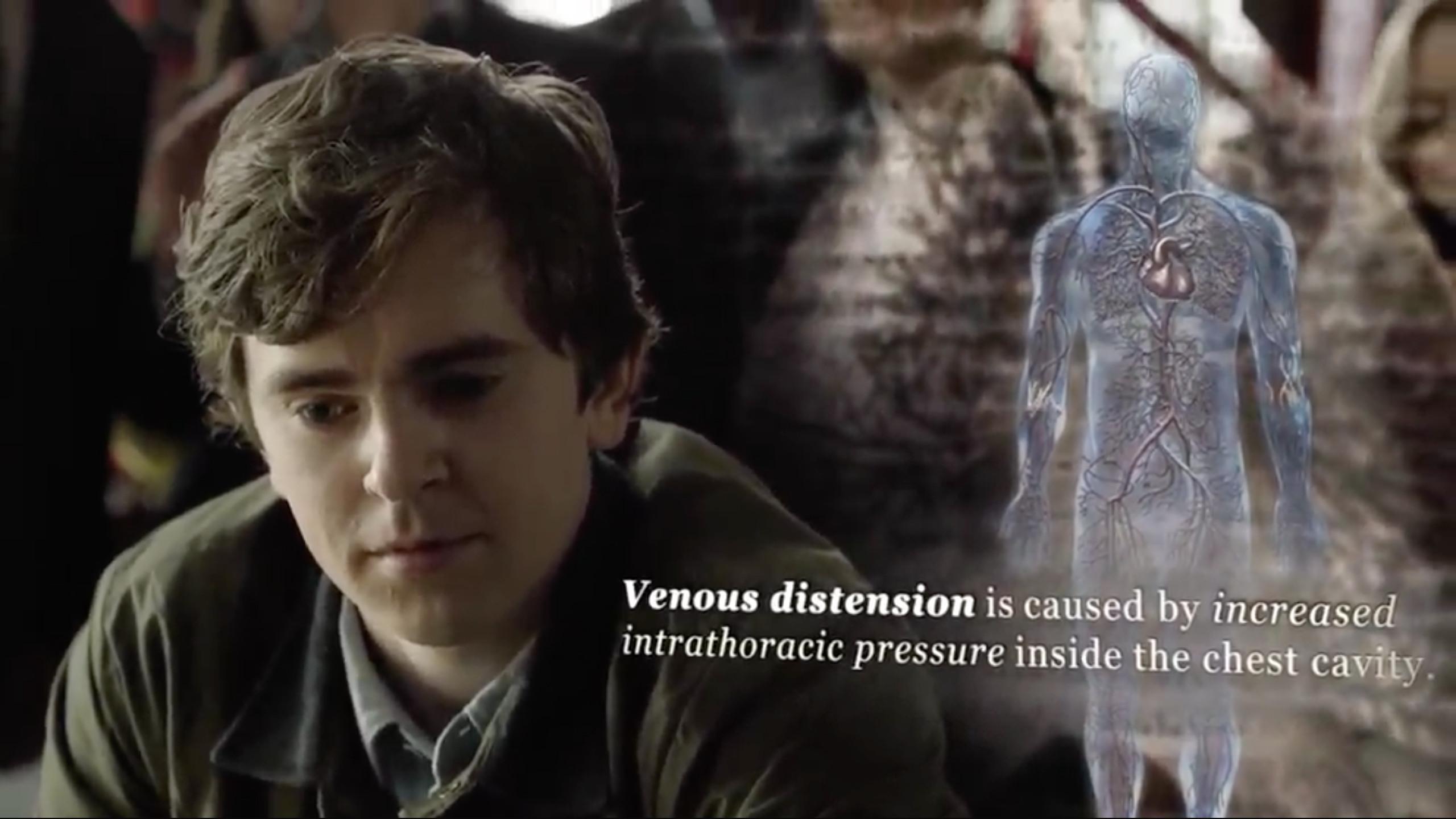 Guy Smokes Tide Pod Hey, Remember the Tide Pod Challenge? The 'Good Doctor' Finale Does! Guy Smokes Tide Pod Hey, Remember the Tide Pod Challenge? The 'Good Doctor' Finale Does!